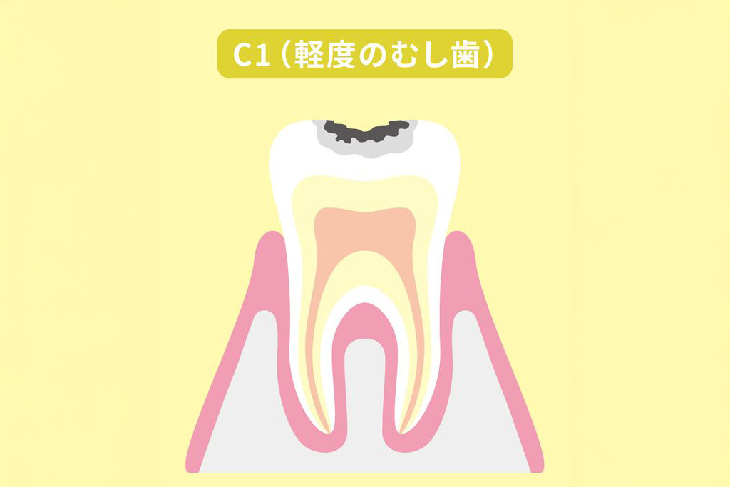 C1