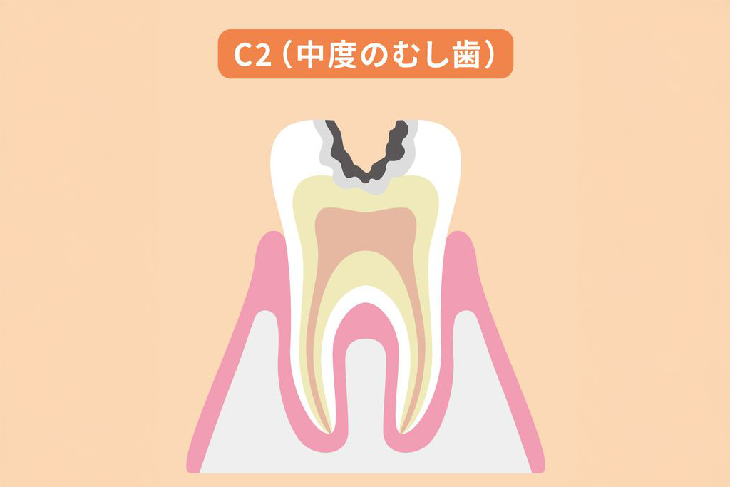 C2