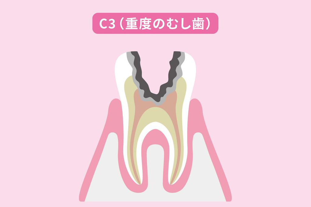 C3