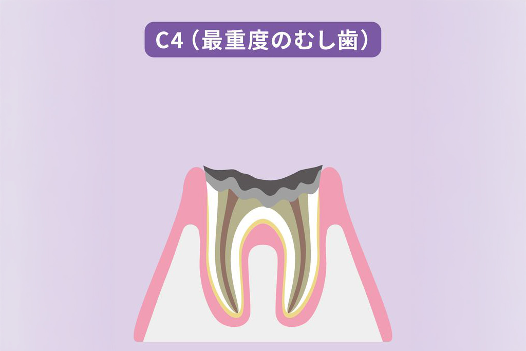 C4